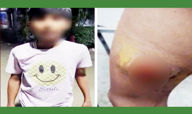 ভারতে ১৩ বছরের এক মুসলিম কিশোরকে হামলার শিকার হতে হয়েছে