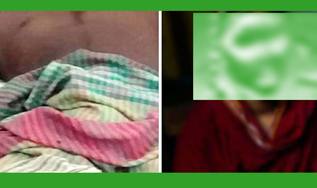 প্রবাসী যুবকের লিঙ্গ কেটে দেন প্রেমিকা