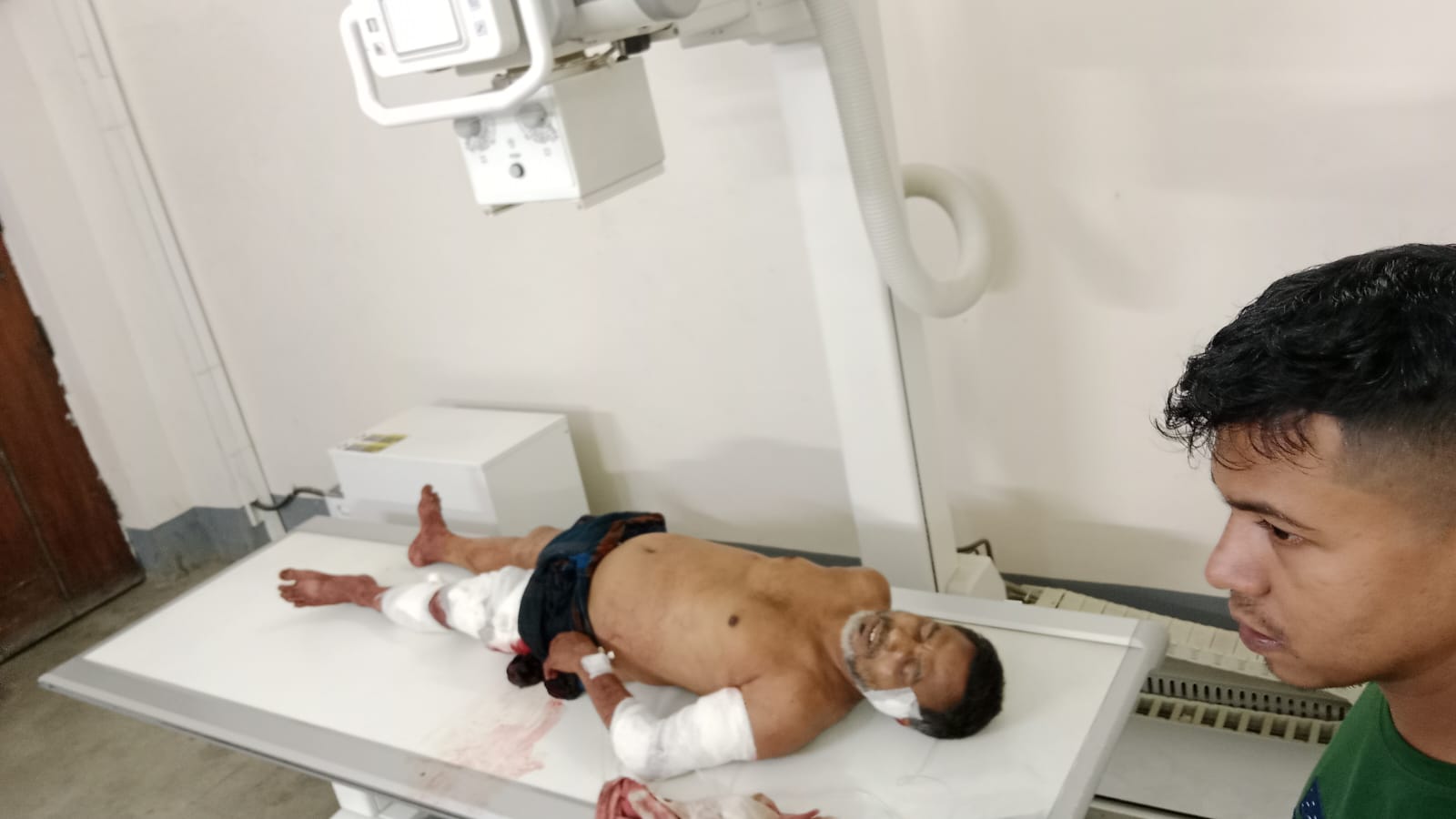 সিলেটে সন্ত্রাসী নাহিদের হামলায় মৃত্যু পথযাএী শওকত ওসমানীতে নগদ টাকা লুট।