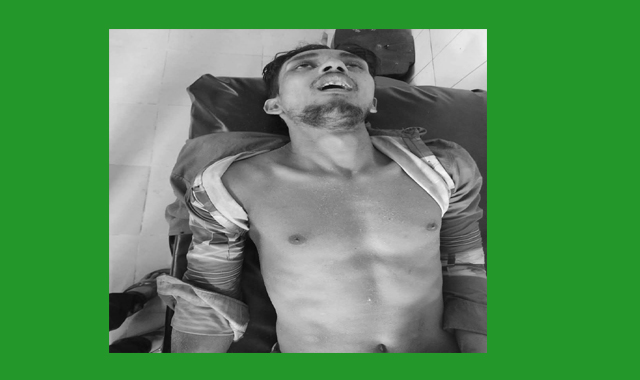 বড়লেখা ডিমাই গ্রামে সিএনজি অটোরিকশা চুরির সময় গণপিটুনি, নিহত ১ জন