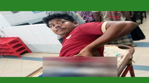 পাখি তাড়াতে ছোড়া গুলিতে এক পরিচ্ছন্নতাকর্মী আহত