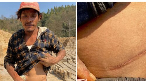কিডনি বিক্রির গ্রাম হোকসে, দালালের প্রতারণার ক্ষত এখনো বয়ে বেড়াচ্ছেন বাসিন্দারা